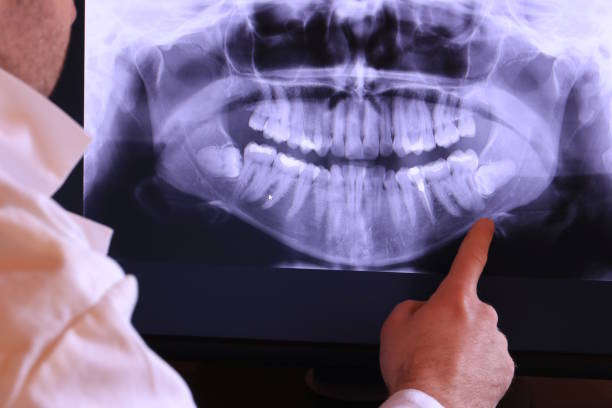 Best Walk-In Emergency Dentist in Salmon Brook, CT