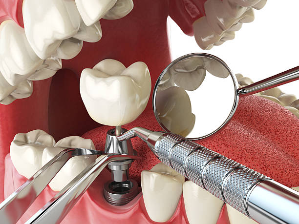 Best Emergency Dental Care for Trauma or Injury in Salmon Brook, CT